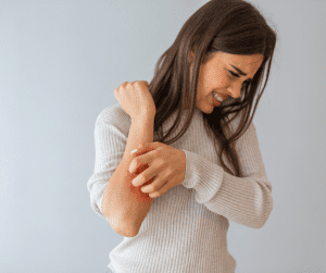 10 Traditional and Effective Methods to Cure Skin Allergies