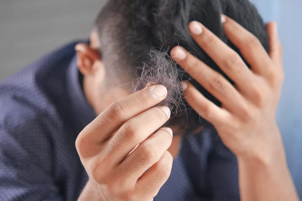 Stop Hair Loss Effectively The PlantTube
