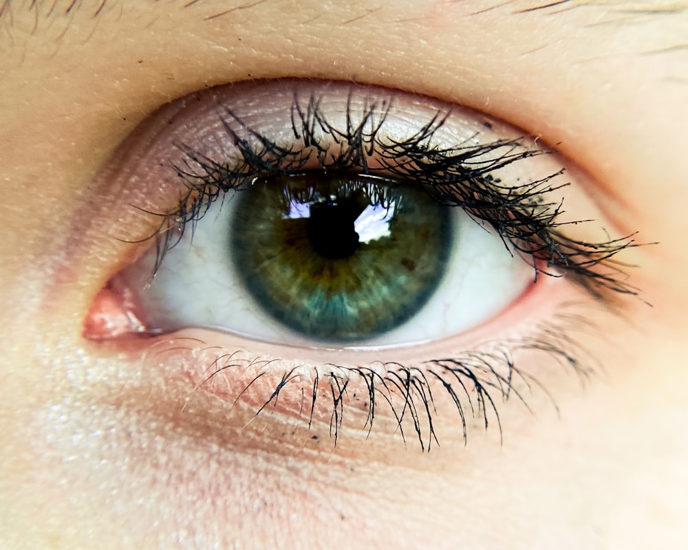 Discover the Powerful Health Benefits of Marigold for Natural Healing 3 Boosts Eye Health